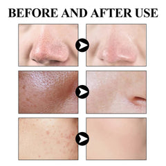 West Month Blackhead Removal Solid Mud Face Mask
