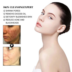 West Month Blackhead Removal Solid Mud Face Mask